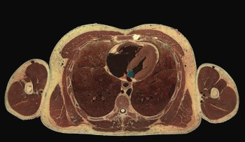 x-sectioned human (45k jpg)